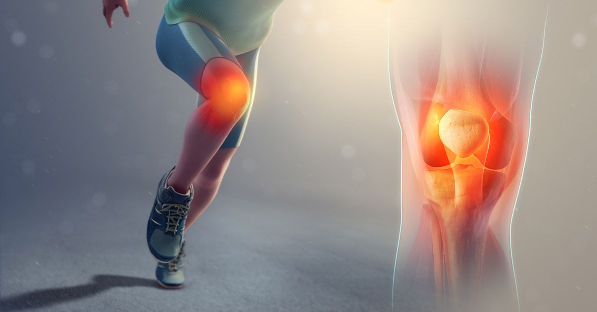 Erkundung vielfältiger und natürlicher Arthritis-Behandlungslösungen für eine dauerhafte Linderung