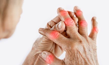 Top-Strategien zur effektiven Linderung von Arthritis-Schmerzen