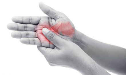 Bewährte Top-Behandlungen gegen Arthritis: Ihr Weg zur Schmerzlinderung